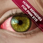 home remedies for pink eye - conjunctivitis android application logo